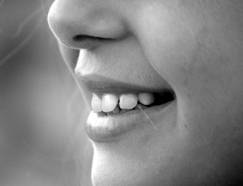 Tooth Replacement Melbourne