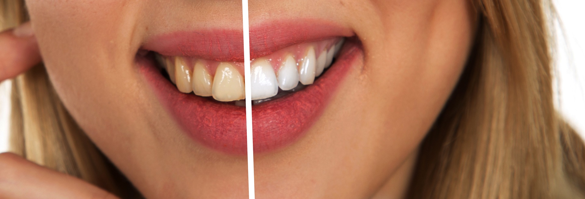 benefits of seeing a prosthodontist