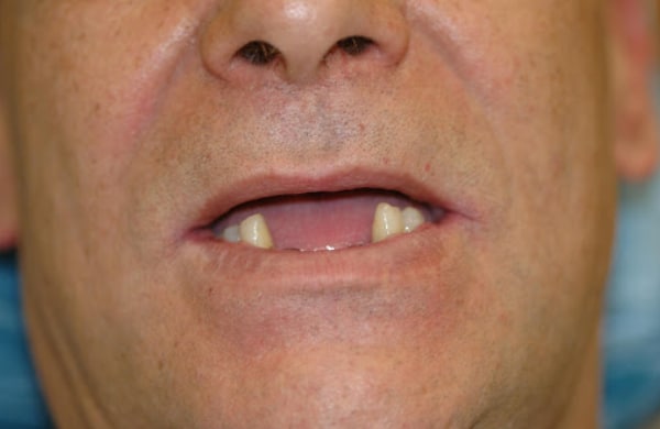 Before