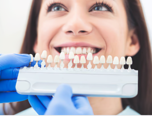 All Teeth Replacement: Comprehensive Solutions for Missing Teeth